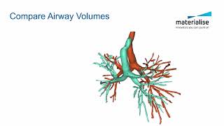 Tutorial: Automatic Pulmonary Segmentation, Design, and Analysis