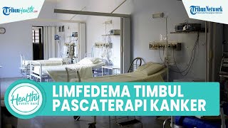 Apa itu Limfedema? Penyakit yang Timbul Pasca Terapi Kanker, Ini Gejala yang Perlu Diwaspadai