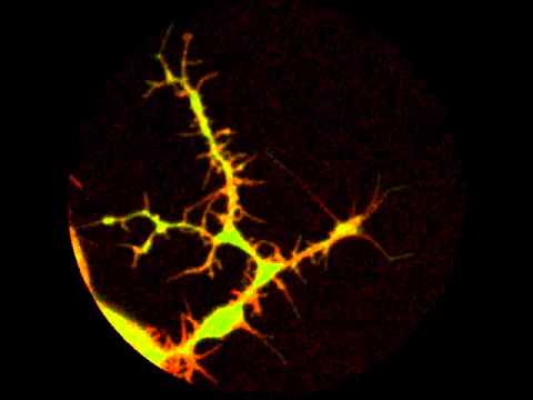 Imaging Cytoskeletal Dynamics (Actin) thumbnail