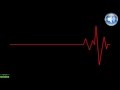 Heartbeat Sound Effect Loud I Human Heartbeat Sound Effect YouTube