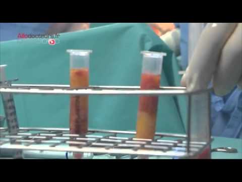 Comment fabriquer un électrostimulateur du pénis