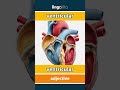 ventricular - ventricular video thumbnail