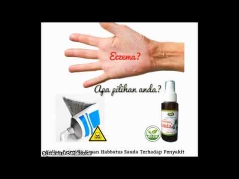 Psoriasi di targa di scarti Che esso è possibile curare la psoriasi di casa