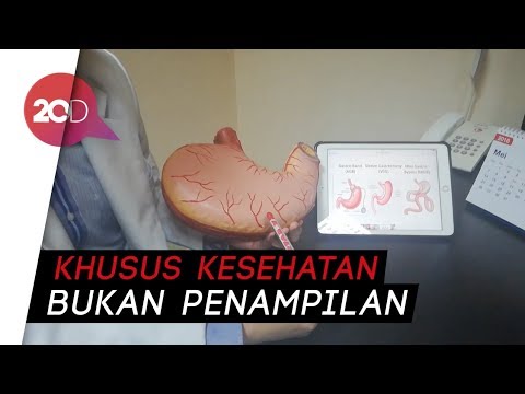 Apakah anggur yang tumbuh tipis Ulasan sepeda dolinova Menurunkan