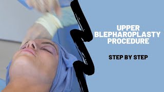 Upper Blepharoplasty - Step by Step Procedure Breakdown