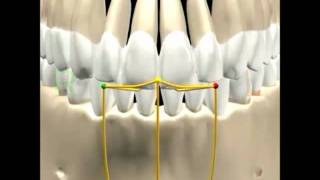 Lateralidade direita e esquerda.avi