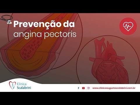 angina pectoris és magas vérnyomás