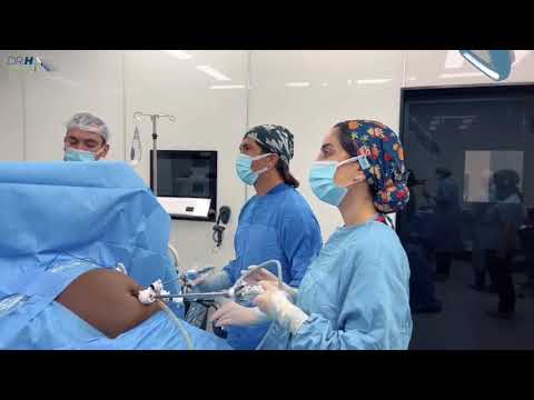 This how l perform the gastric sleeve surgery.Full Video! #tüpmide #obezitecerrahisi #gastricsleeve