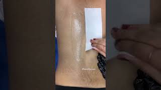 Satisfying back waxing results #backwaxing #eyebrows #waxing #shorts #winnipeg #viral