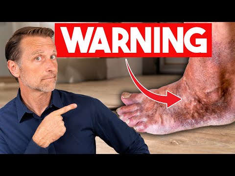 These Foot Symptoms Could Mean Something Serious