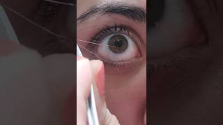 eye mucus removal. eye fishing syndrome #eyes #eyeirritation
