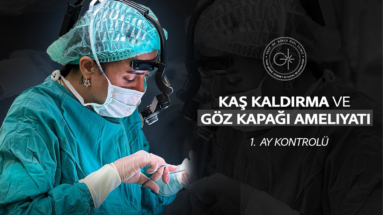 KAŞ KALDIRMA, ALT VE ÜST GÖZ KAPAĞI AMELİYATI I 1. AY KONTROLÜ #gözkapağıestetiği #kaşkaldırma
