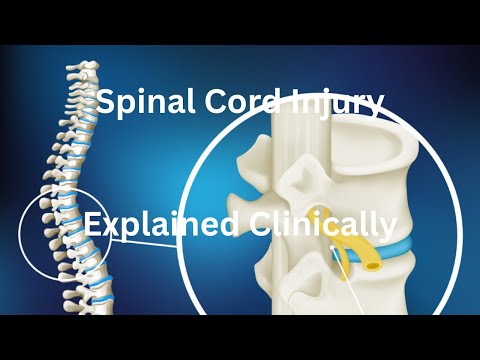Spinal Cord Injury Explained: Pathophysiology, ASIA Classification & Rehabilitation Strategies