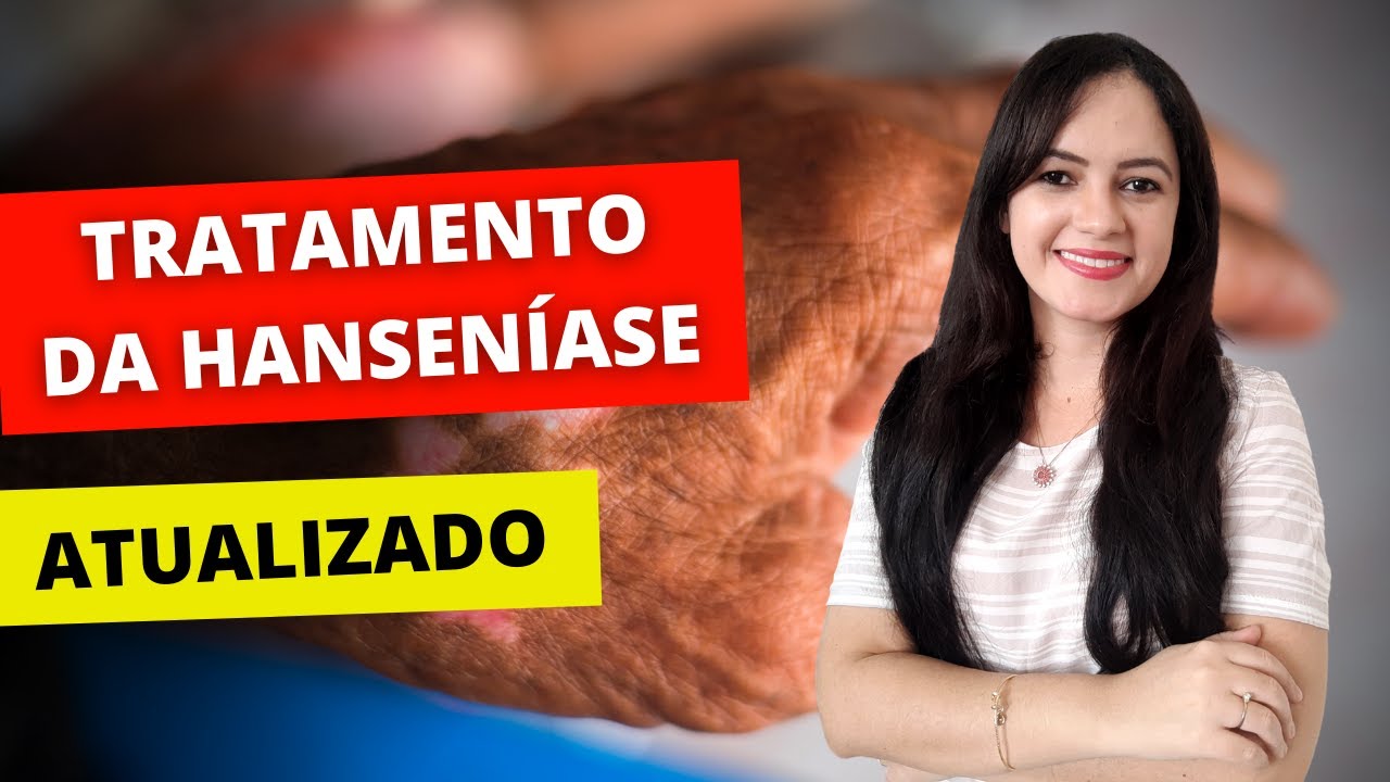 Tratamento da Hanseníase: o que mudou? (Profª Juliana Mello)