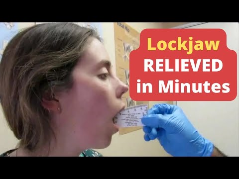 😬⚡ Unbearable Lockjaw Pain UNLOCKED FAST with ASTR! THIS WORKS!! 💥 😲