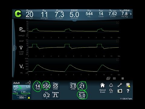 Vent Modes 101! Focus on the Waveform -- BAVLS