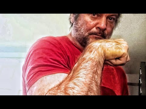 DEVON INJURY INCOMING...