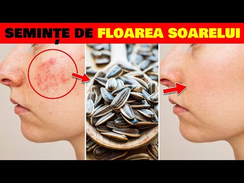 DACĂ MĂNÂNCI SEMINȚE DE FLOAREA SOARELUI ÎN FIECARE ZI IATĂ CE SE VA ÎNTÂMPLA CU ORGANISMUL TĂU!