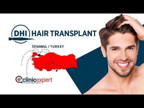 Hair Transplant at ClinicExpert : DHI explained !
