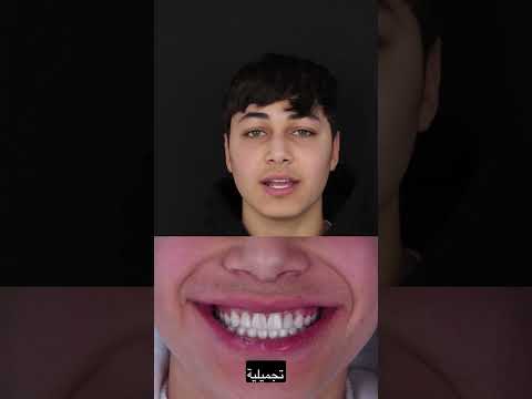 مصر – إعادة تأهيل