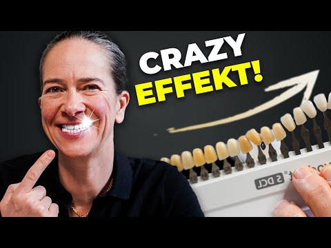 Der "geheime" weisse Zähne-Trick gelüftet...(So klappt's!)