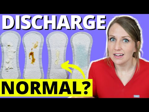 Doctor Answers Top 5 Discharge Questions