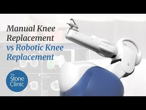 Robotic Knee Replacement vs. Manual Knee Replacement - What You Need To Know