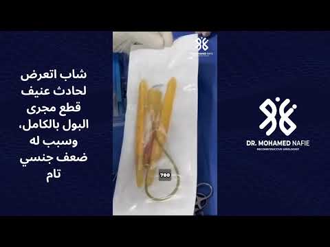 شاب اتعرض لحادث عنيف قطع مجرى البول بالكامل، وسبب له ضعف جنسي تام