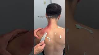 Scraping the upper traps #chiropractor #stretch #physiotherapy #fitness #backpain #workout
