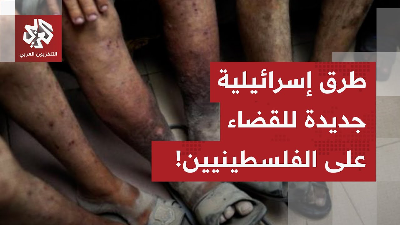 بأمراض جلدية خطيرة.. إسرائيل تنتهج سياسة القضاء على الفلسطينيين عن طريق الأم?