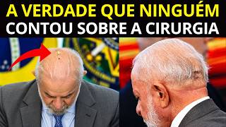 A VERDADE APARECEU SOBRE A NOVA CIRURGIA DE LULA QUE ESTÃO TENTANDO ESCONDER DO POVO...