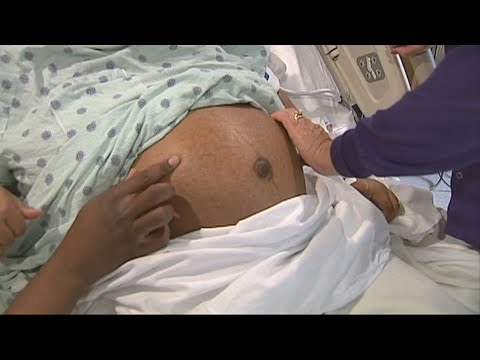 New study shows another hidden danger of the coronavirus in pregnancy