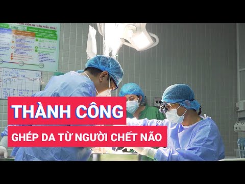 , title : 'Lần đầu tiên ghép da từ người cho chết não ở Việt Nam'