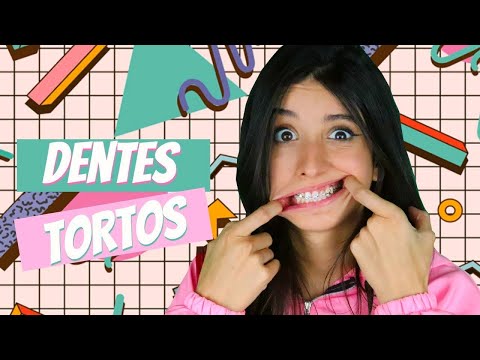 download lagu mp3 mp4 Sorriso Torto, download lagu Sorriso Torto gratis, unduh video klip Sorriso Torto