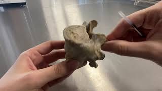 Servikal, torakal, lumbal vertebralar, Os sacrum