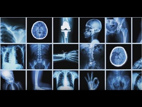 What You Need to Know Before You Get an X-ray
