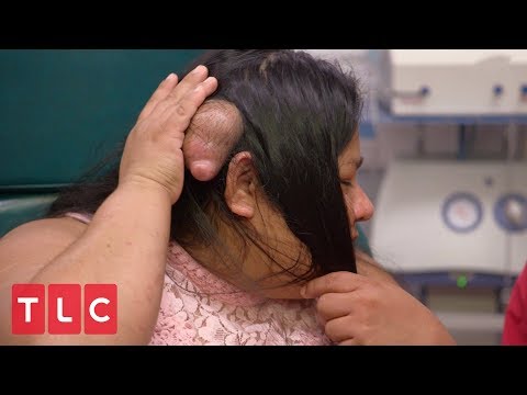 A Life Destroying Bump | Dr. Pimple Popper