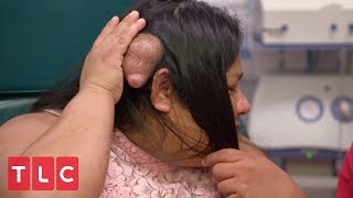 A Life Destroying Bump | Dr. Pimple Popper