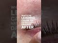 What is the leading cause to damaged natural lashes after lash extensions