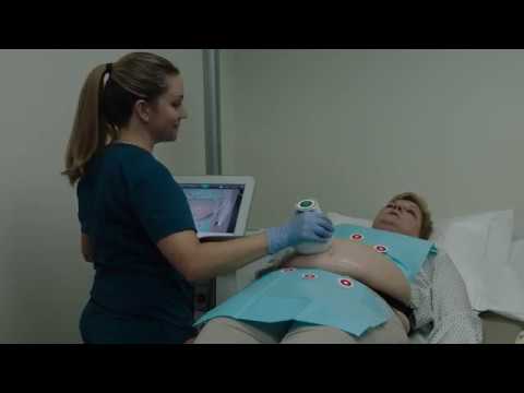 Ultra Shape Power 01 10 18