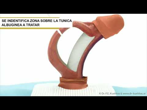 Cosa fare se ti fa male le vertebre nella parte bassa della schiena Farmaci per il trattamento del mal di schiena