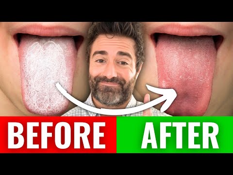 Eat These 7 Foods EVERY DAY for SIFO & Candida