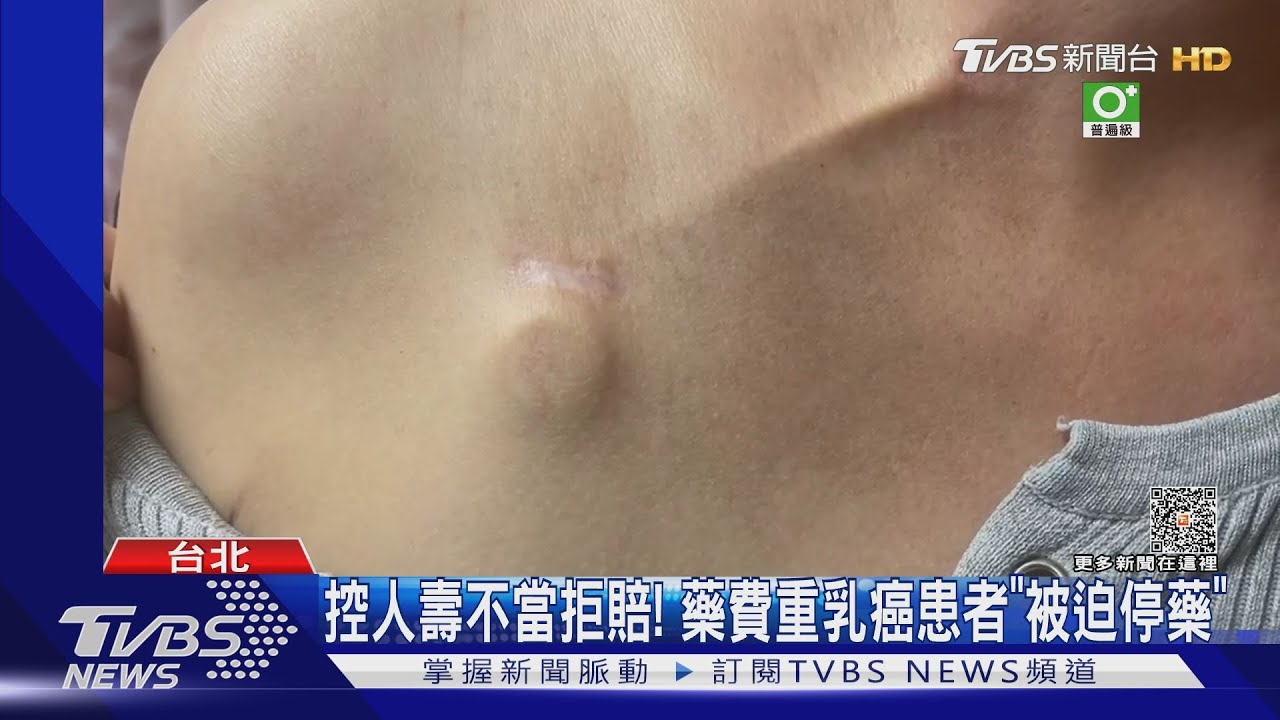 控人壽不當拒賠！藥費重乳癌患者「被迫停藥」