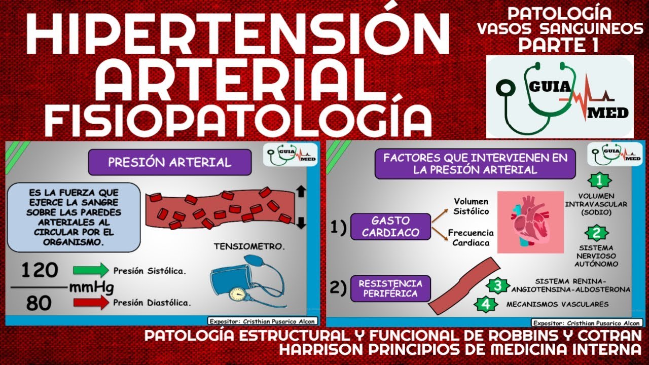 HIPERTENSIÓN ARTERIAL HARRRISON | GuiaMed