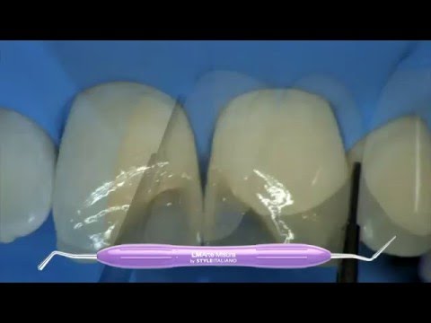 LM Arte Clinical Case