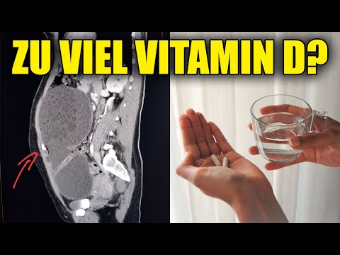 Was Passiert Wenn Du 10.000 IE Vitamin D Am Tag Nimmst?