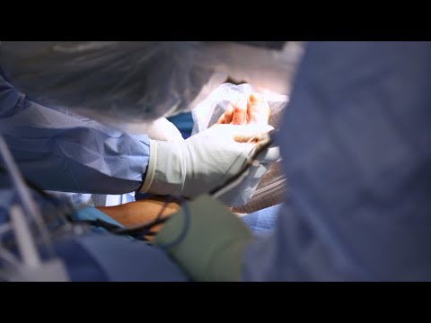 Minimally Invasive Bunion Surgery