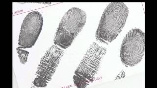 Radial Loop Archive Instruction.mp4