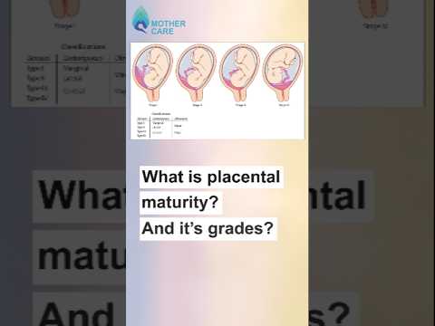 What is Placenta Maturity? | Dr Supriya Puranik #mothercare #drsupriyapuranik #placentamaturity