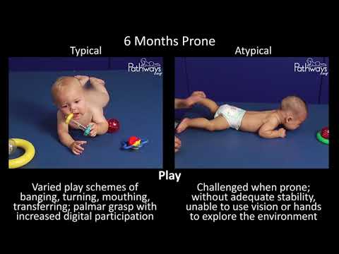 6 Month Old Baby Typical & Atypical Development Side by Side